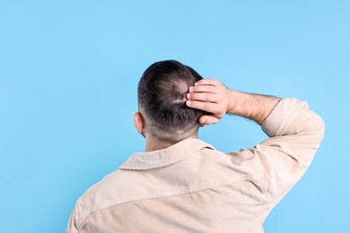 Photo of Baldness problem. Man with bald spot on light blue background, back view