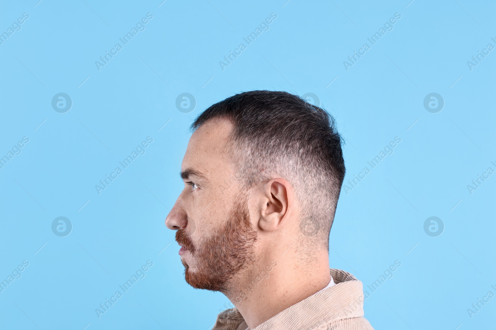 Photo of Baldness problem. Man with receding hairline on light blue background