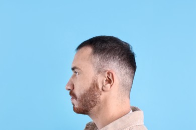 Photo of Baldness problem. Man with receding hairline on light blue background