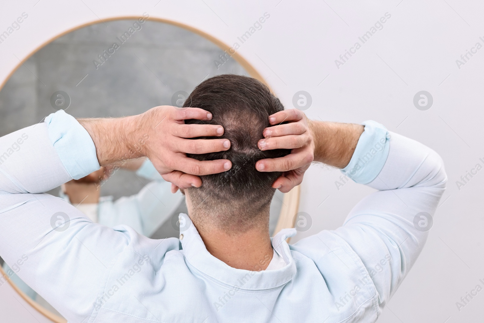 Photo of Baldness problem. Man with receding hairline near mirror in bathroom, back view