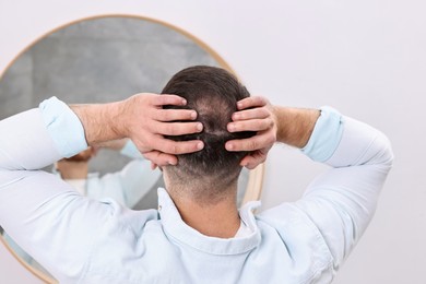 Baldness problem. Man with receding hairline near mirror in bathroom, back view