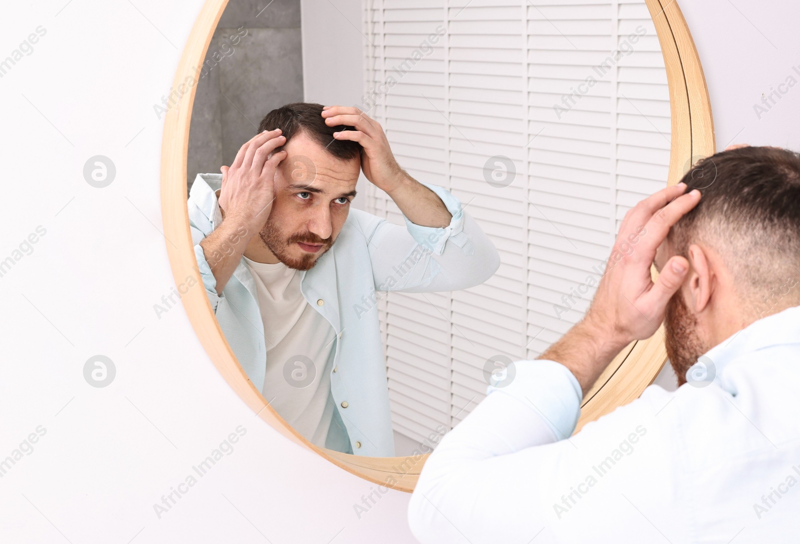 Photo of Baldness problem. Man with receding hairline near mirror in bathroom