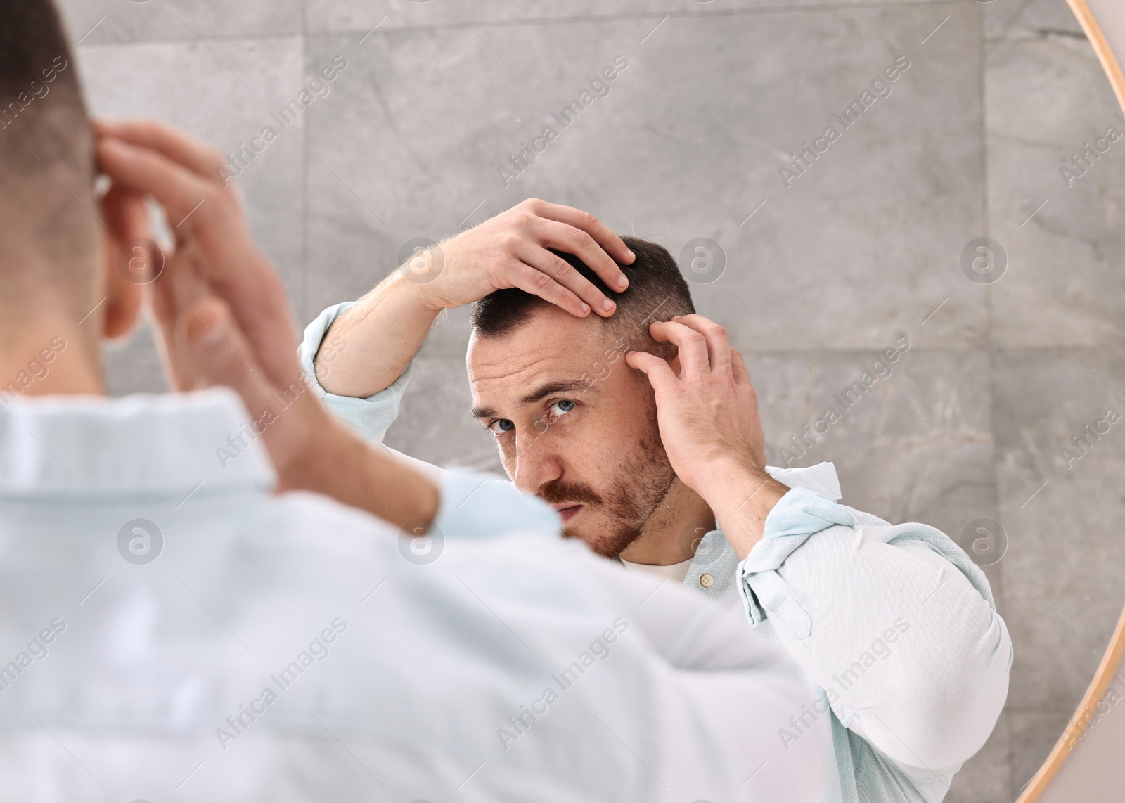 Photo of Baldness problem. Man with receding hairline near mirror in bathroom