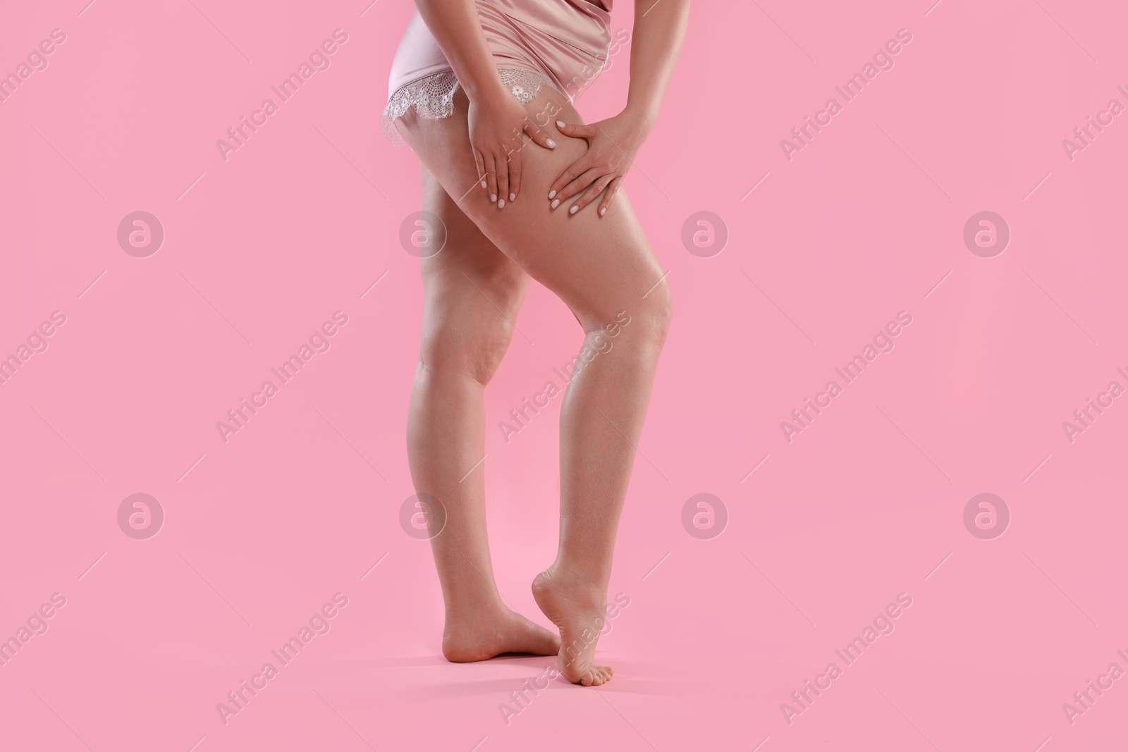 Photo of Woman with cellulite on pink background, closeup