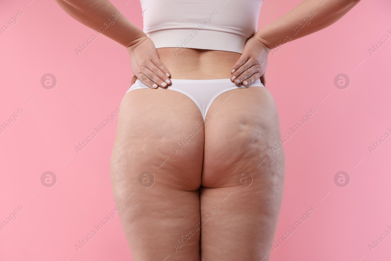 Photo of Woman with cellulite on pink background, closeup