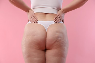 Photo of Woman with cellulite on pink background, closeup