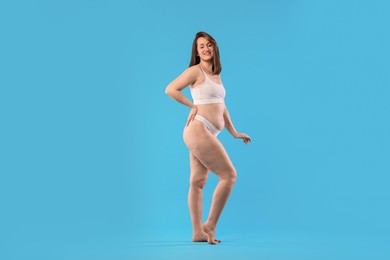 Woman in underwear on light blue background. Cellulite problem