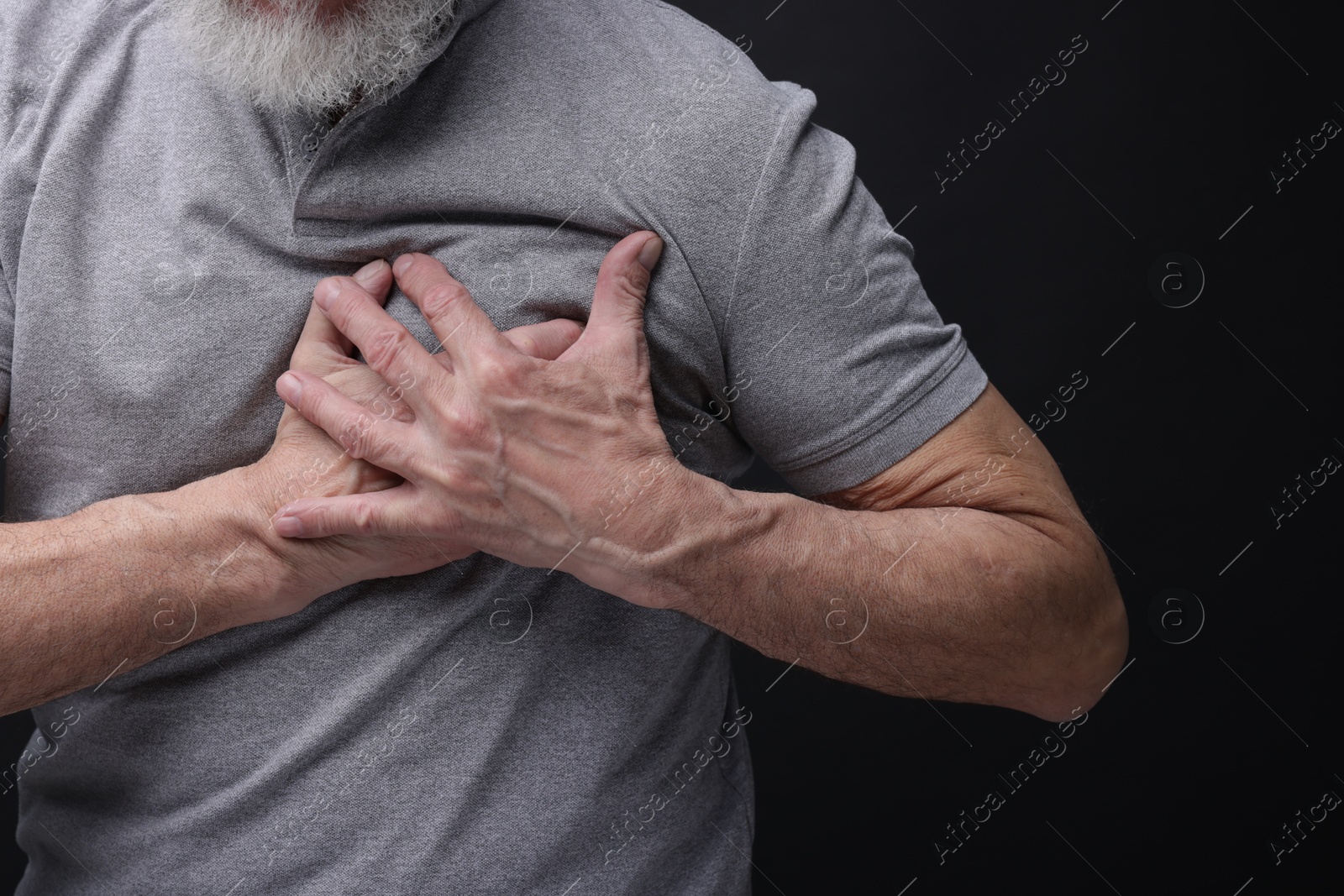 Photo of Heart attack. Senior man suffering from pain in chest on black background, closeup