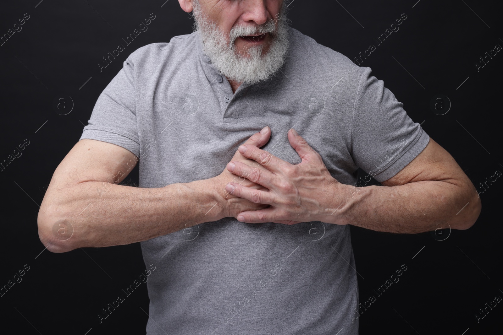 Photo of Heart attack. Senior man suffering from pain in chest on black background, closeup