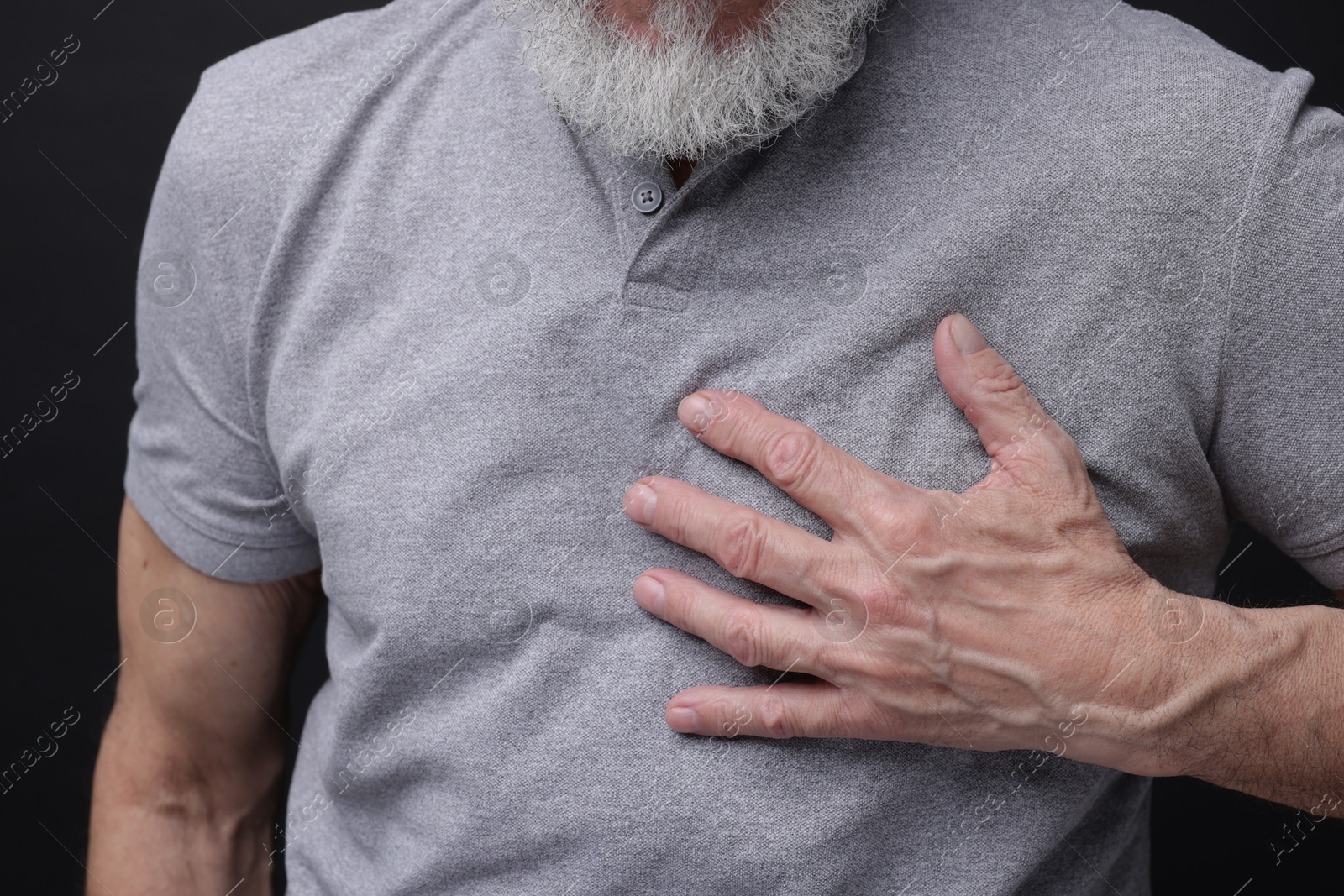 Photo of Heart attack. Senior man suffering from pain in chest on black background, closeup