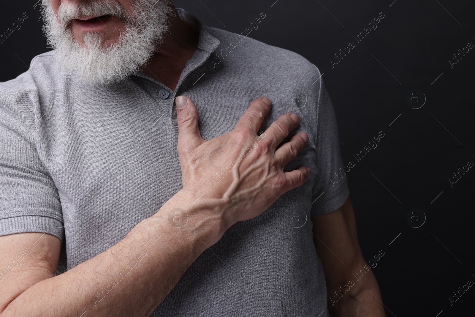 Photo of Heart attack. Senior man suffering from pain in chest on black background, closeup. Space for text