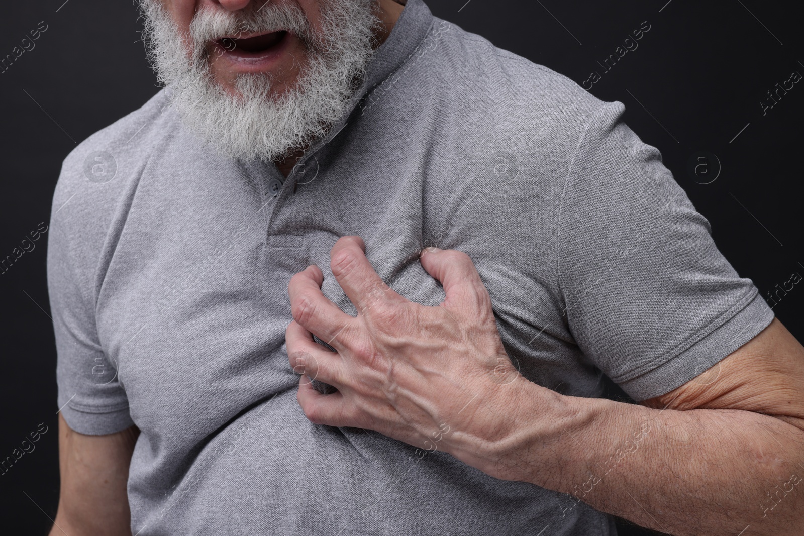 Photo of Heart attack. Senior man suffering from pain in chest on black background, closeup