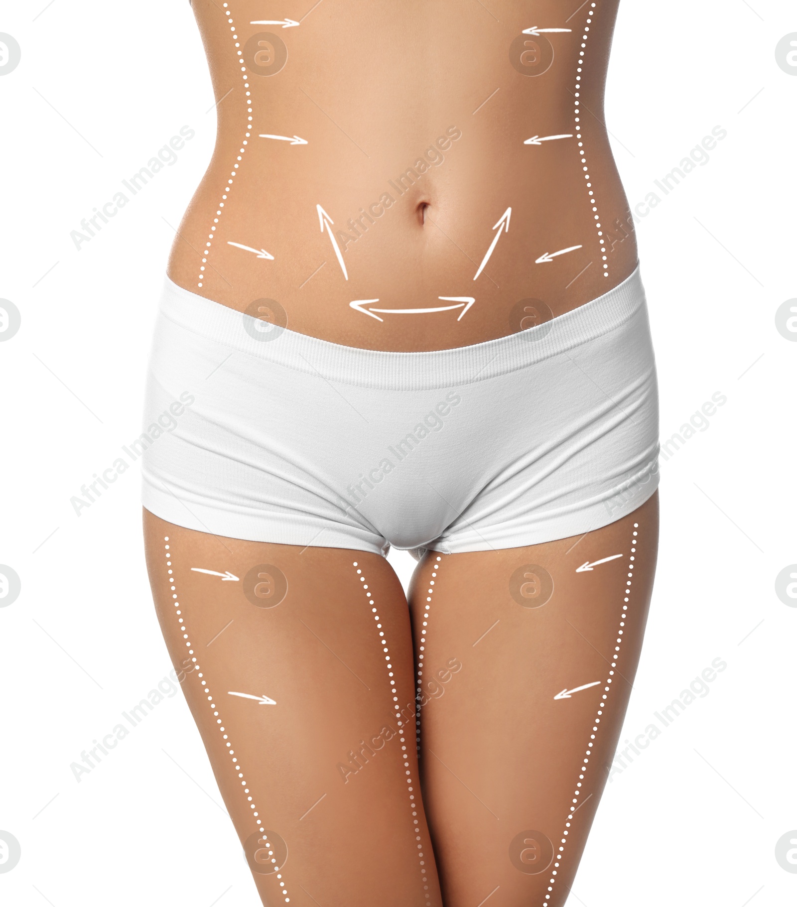 Image of Plastic surgery. Woman with perfect slim body on white background, closeup. Figure correction arrows and lines on skin