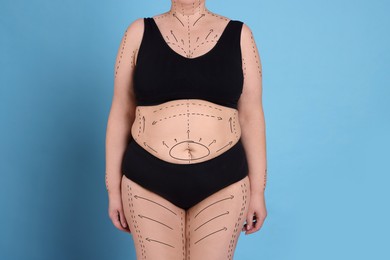 Image of Plastic surgery. Woman with excessive fat on light blue background, closeup. Figure correction arrows and lines on skin