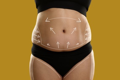 Image of Plastic surgery. Woman with excessive fat on dark yellow background, closeup. Figure correction arrows and lines on skin