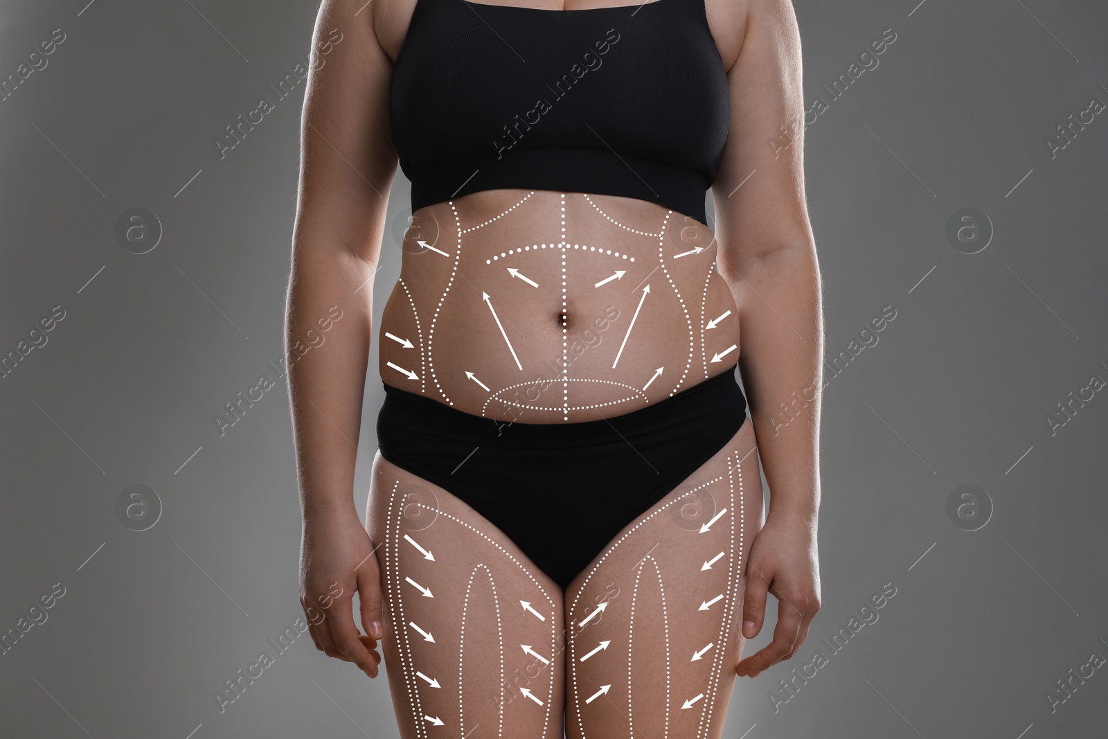 Image of Plastic surgery. Woman with excessive fat on grey background, closeup. Figure correction arrows and lines on skin