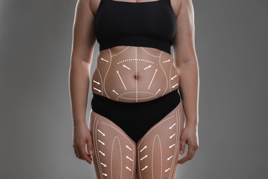 Image of Plastic surgery. Woman with excessive fat on grey background, closeup. Figure correction arrows and lines on skin