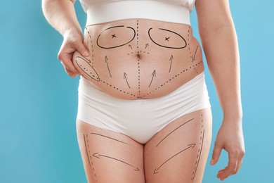 Image of Plastic surgery. Woman with excessive fat on light blue background, closeup. Figure correction arrows and lines on skin