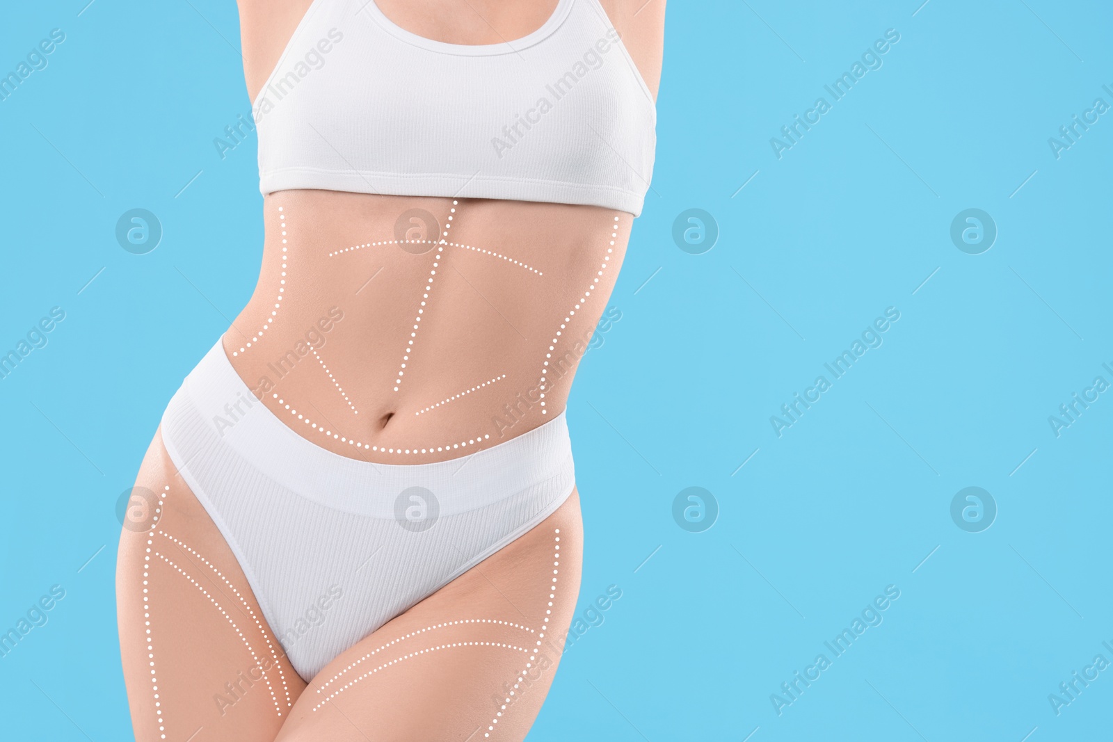 Image of Plastic surgery. Woman with perfect slim body on light blue background, closeup. Figure correction lines on skin