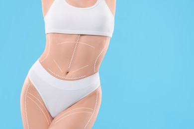 Image of Plastic surgery. Woman with perfect slim body on light blue background, closeup. Figure correction lines on skin