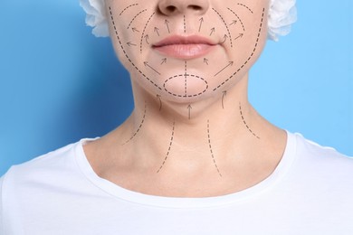 Image of Plastic surgery. Mature woman with double chin on light blue background, closeup. Correction arrows and lines on skin