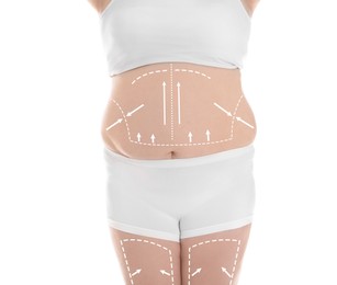 Image of Plastic surgery. Woman with excessive fat on white background, closeup. Figure correction arrows and lines on skin