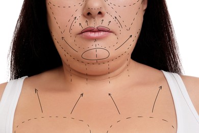 Image of Plastic surgery. Woman with double chin on white background, closeup. Correction arrows and lines on skin