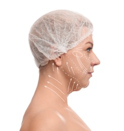 Image of Plastic surgery. Mature woman with double chin on white background. Correction arrows and lines on skin