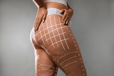 Image of Plastic surgery. Woman with excessive fat and cellulite on grey background, closeup. Figure correction arrows and lines on skin