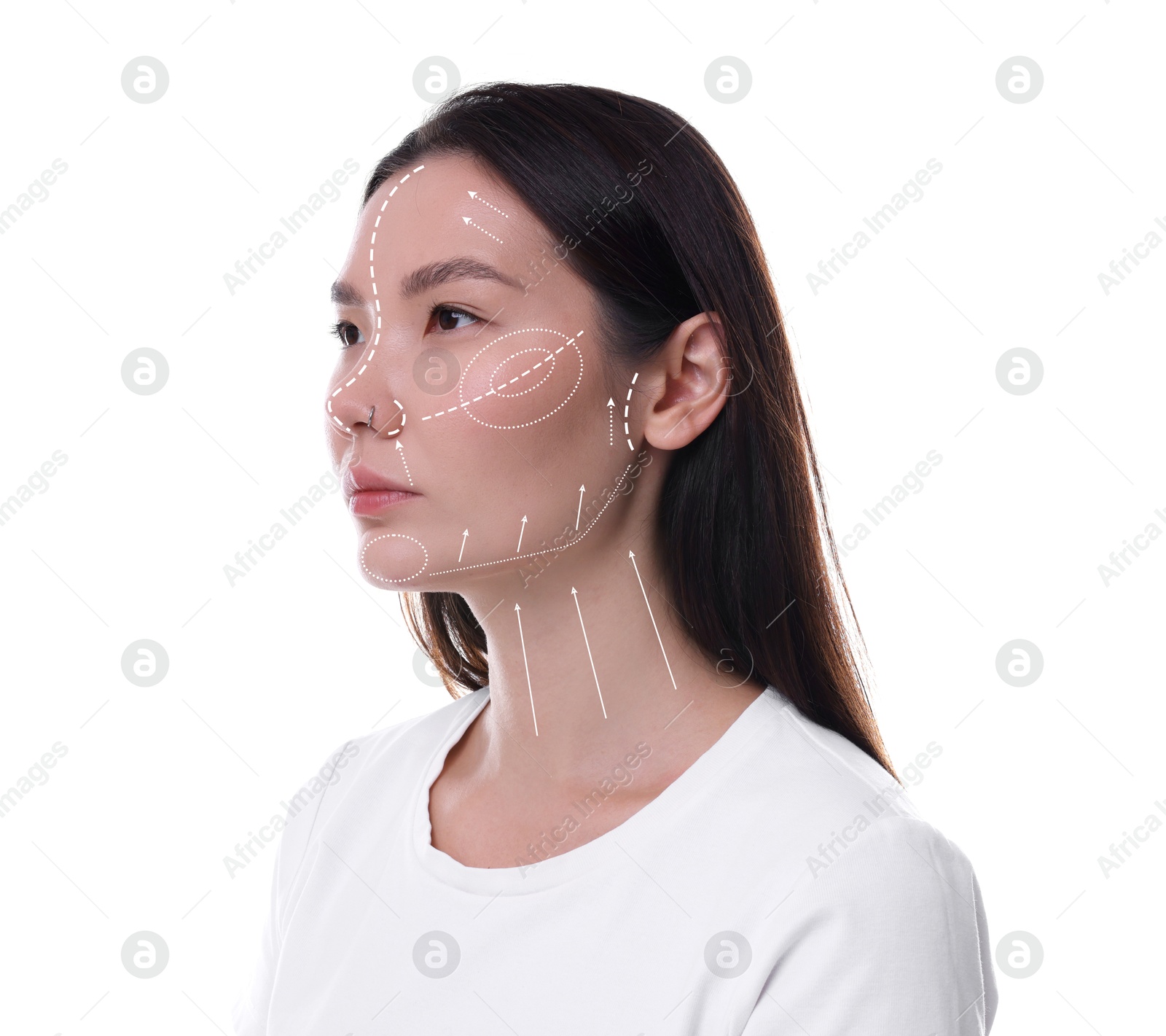 Image of Plastic surgery. Beautiful woman on white background. Correction arrows and lines on skin