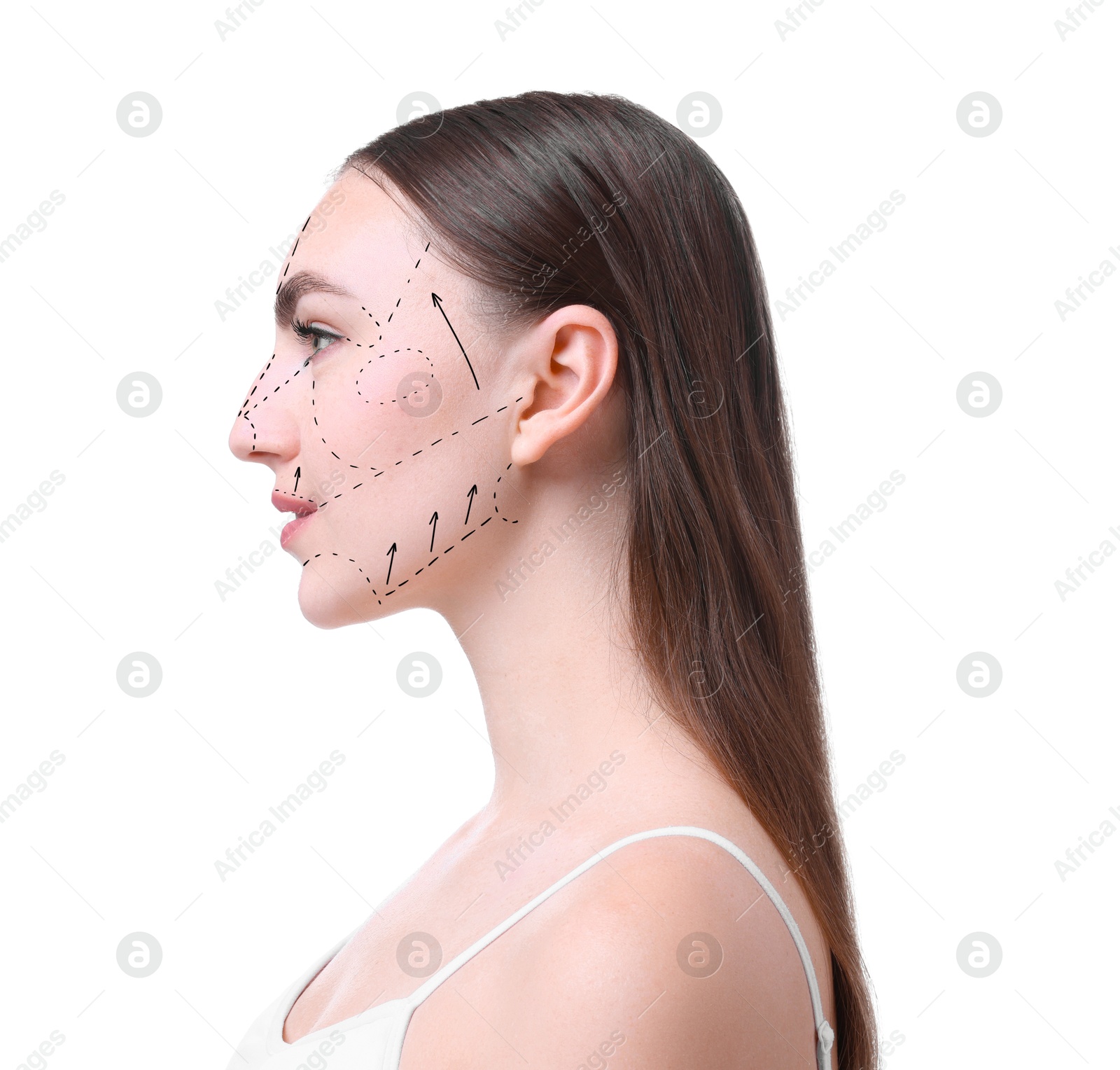 Image of Plastic surgery. Beautiful woman on white background. Correction arrows and lines on skin