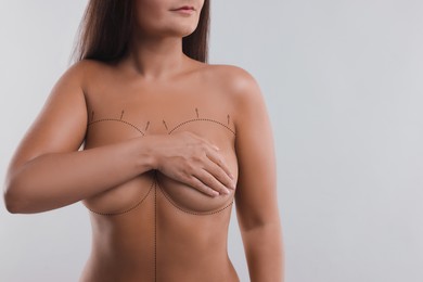 Image of Plastic surgery. Woman covering her breasts on light background, closeup. Correction arrows and lines on skin