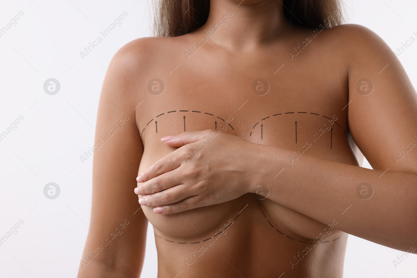 Image of Plastic surgery. Woman covering her breasts on white background, closeup. Correction arrows and lines on skin