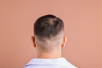 Baldness problem. Man with bald spot on dark beige background, back view