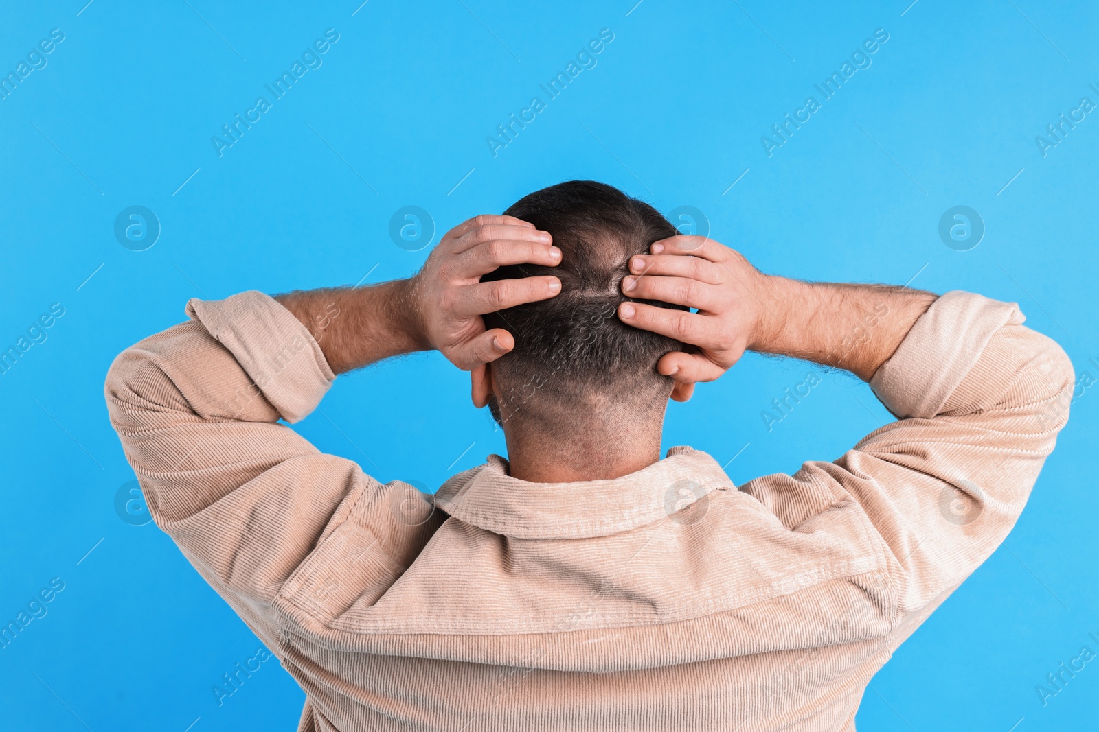 Photo of Baldness problem. Man with bald spot on light blue background, back view