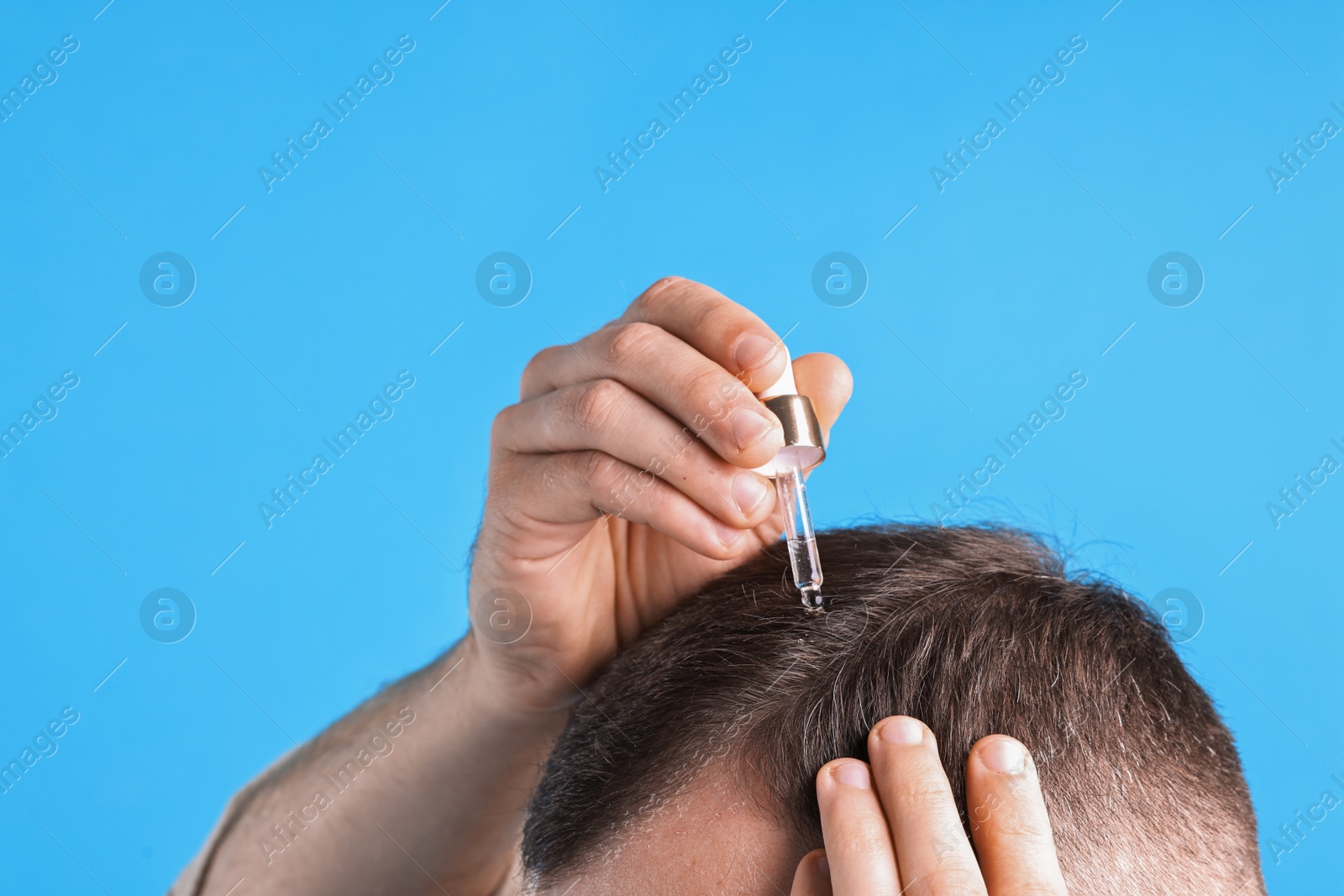 Photo of Baldness problem. Man applying serum onto hairline on light blue background, closeup