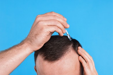 Baldness problem. Man applying serum onto hairline on light blue background, closeup