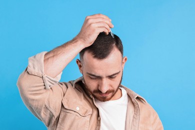 Photo of Baldness problem. Man applying serum onto hairline on light blue background