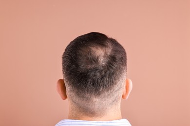 Photo of Baldness problem. Man with bald spot on dark beige background, back view