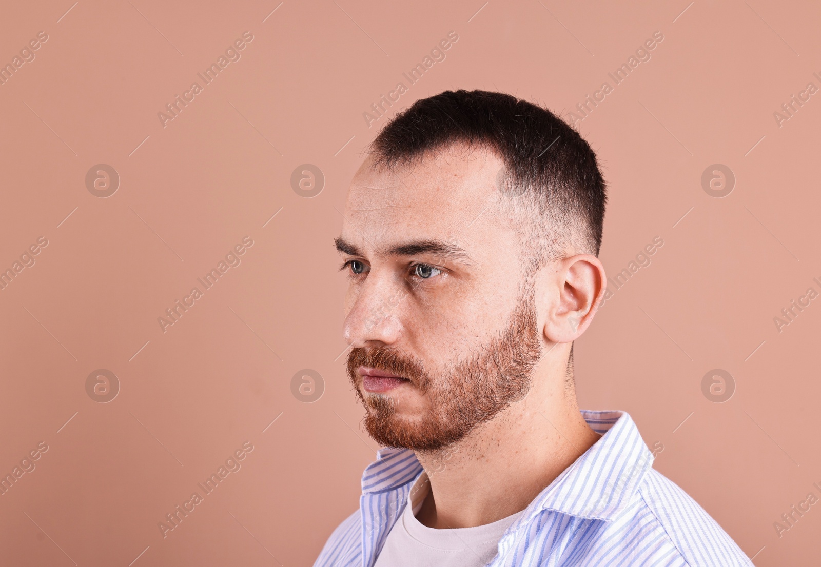 Photo of Baldness problem. Man with receding hairline on dark beige background, space for text