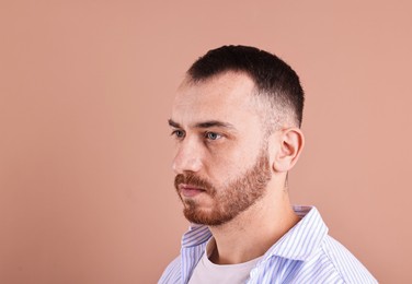 Baldness problem. Man with receding hairline on dark beige background, space for text