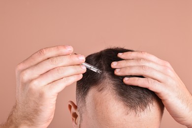 Baldness problem. Man applying serum onto hairline on dark beige background, closeup