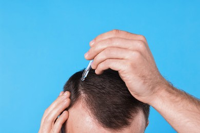 Baldness problem. Man applying serum onto hairline on light blue background, closeup