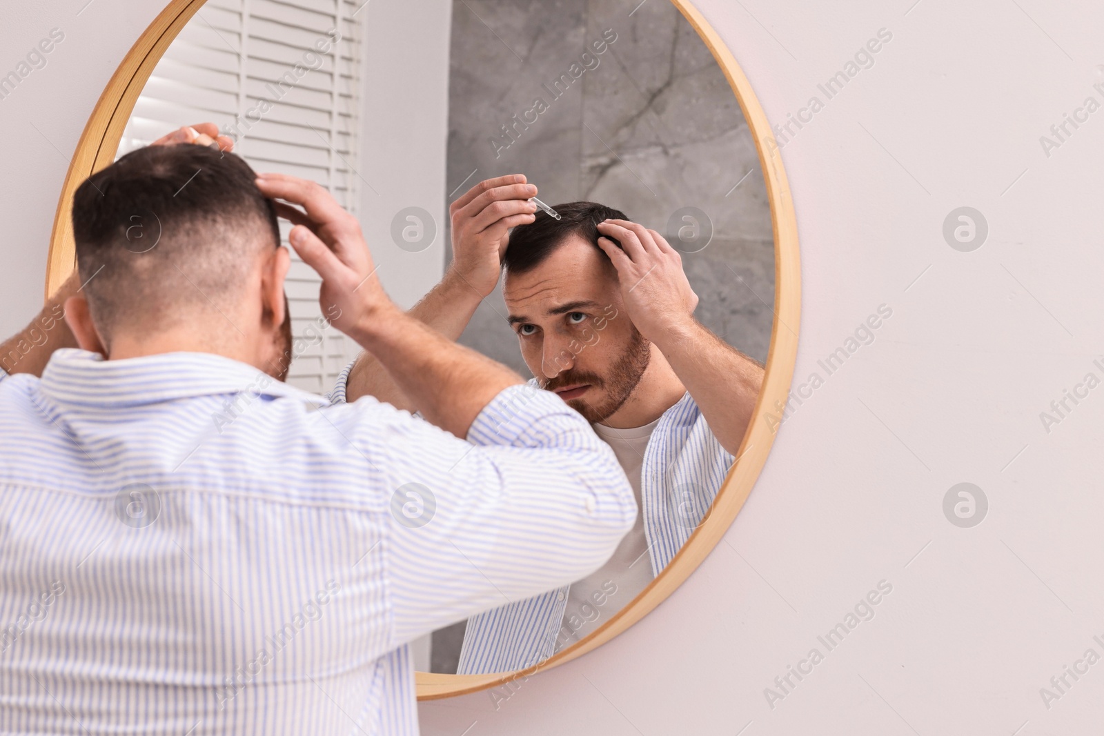 Photo of Baldness problem. Man applying serum onto hairline near mirror in bathroom