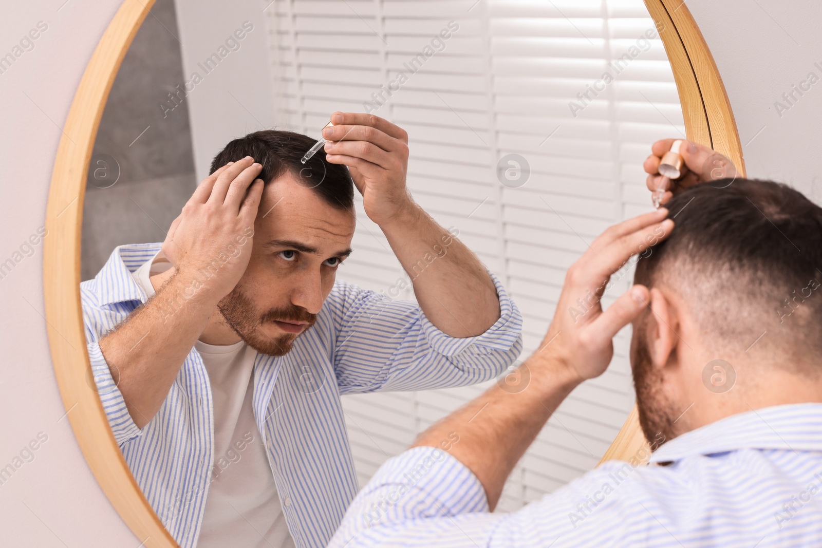 Photo of Baldness problem. Man applying serum onto hairline near mirror in bathroom