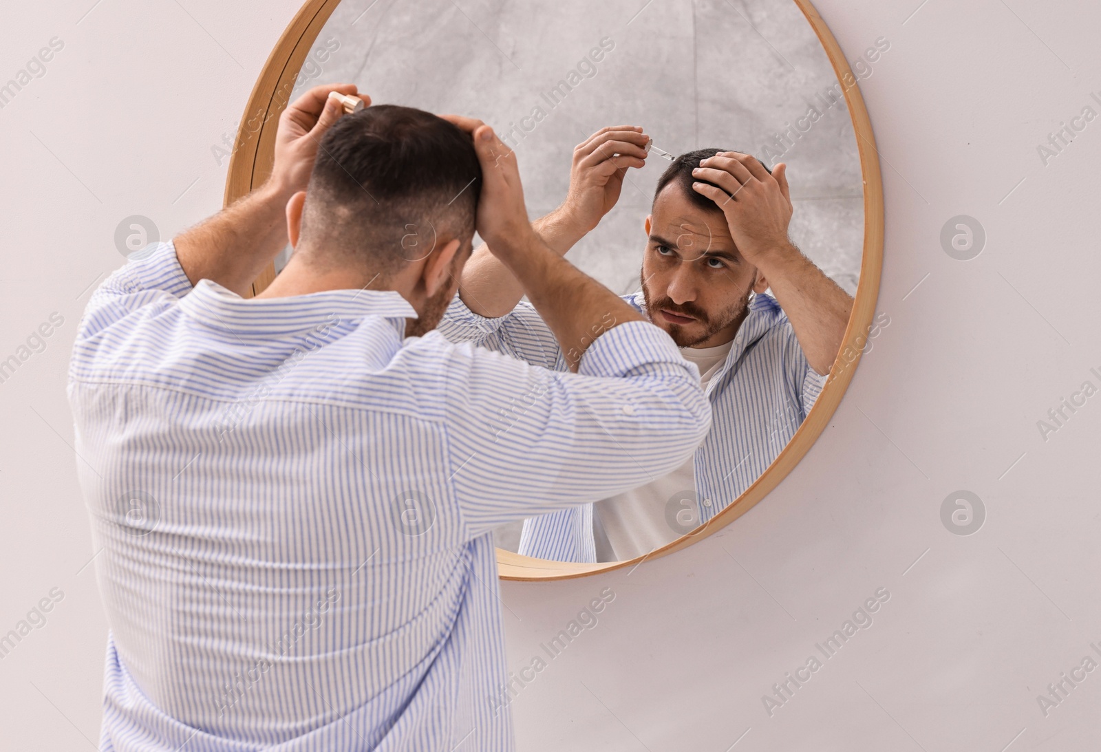 Photo of Baldness problem. Man applying serum onto hairline near mirror in bathroom