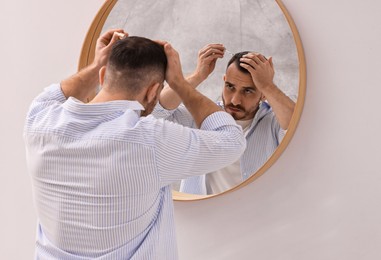 Baldness problem. Man applying serum onto hairline near mirror in bathroom