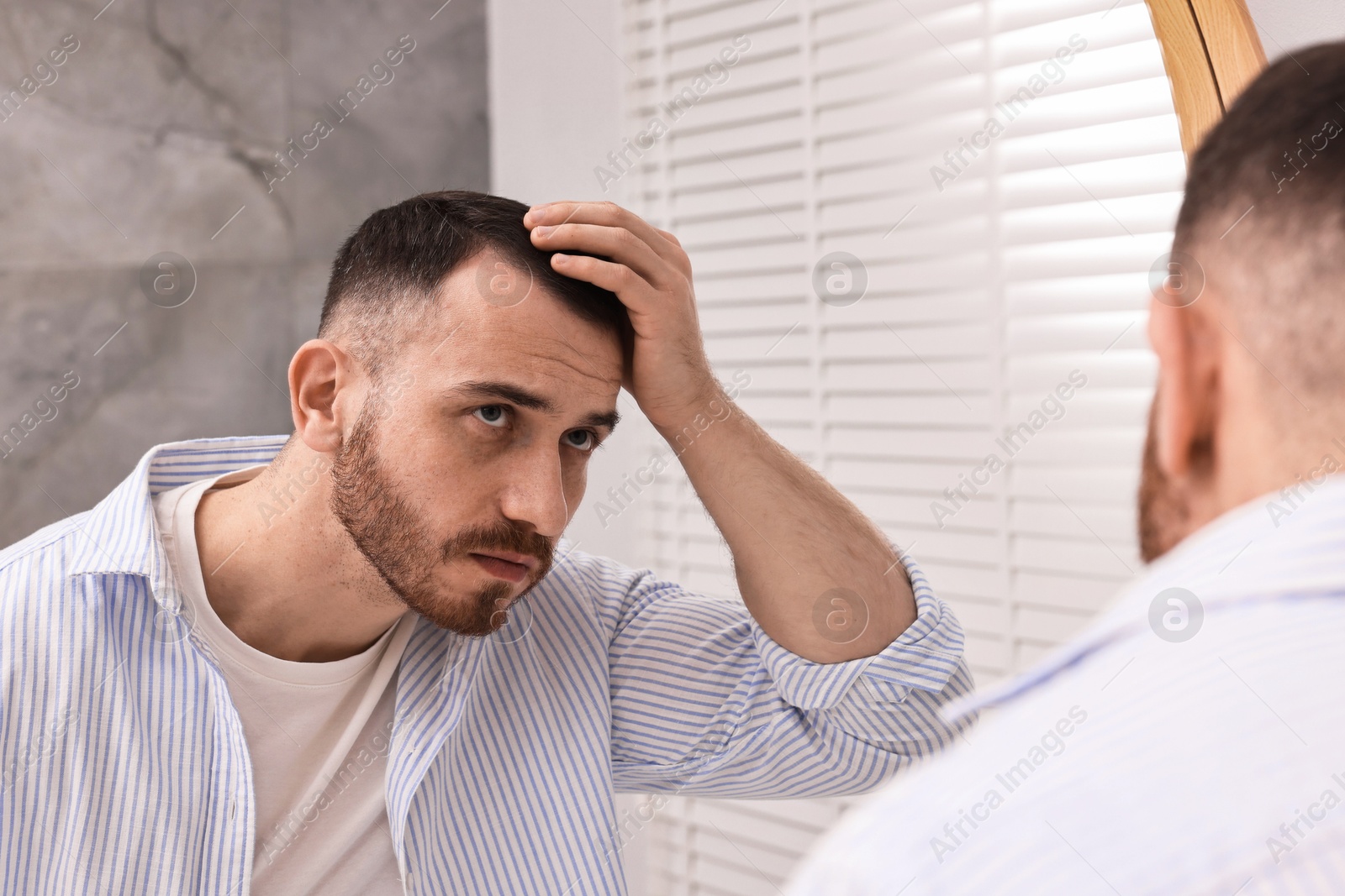 Photo of Baldness problem. Man with receding hairline near mirror in bathroom