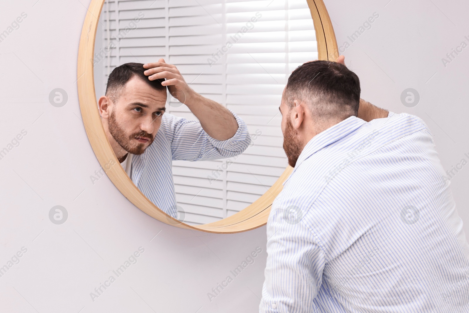 Photo of Baldness problem. Man with receding hairline near mirror in bathroom