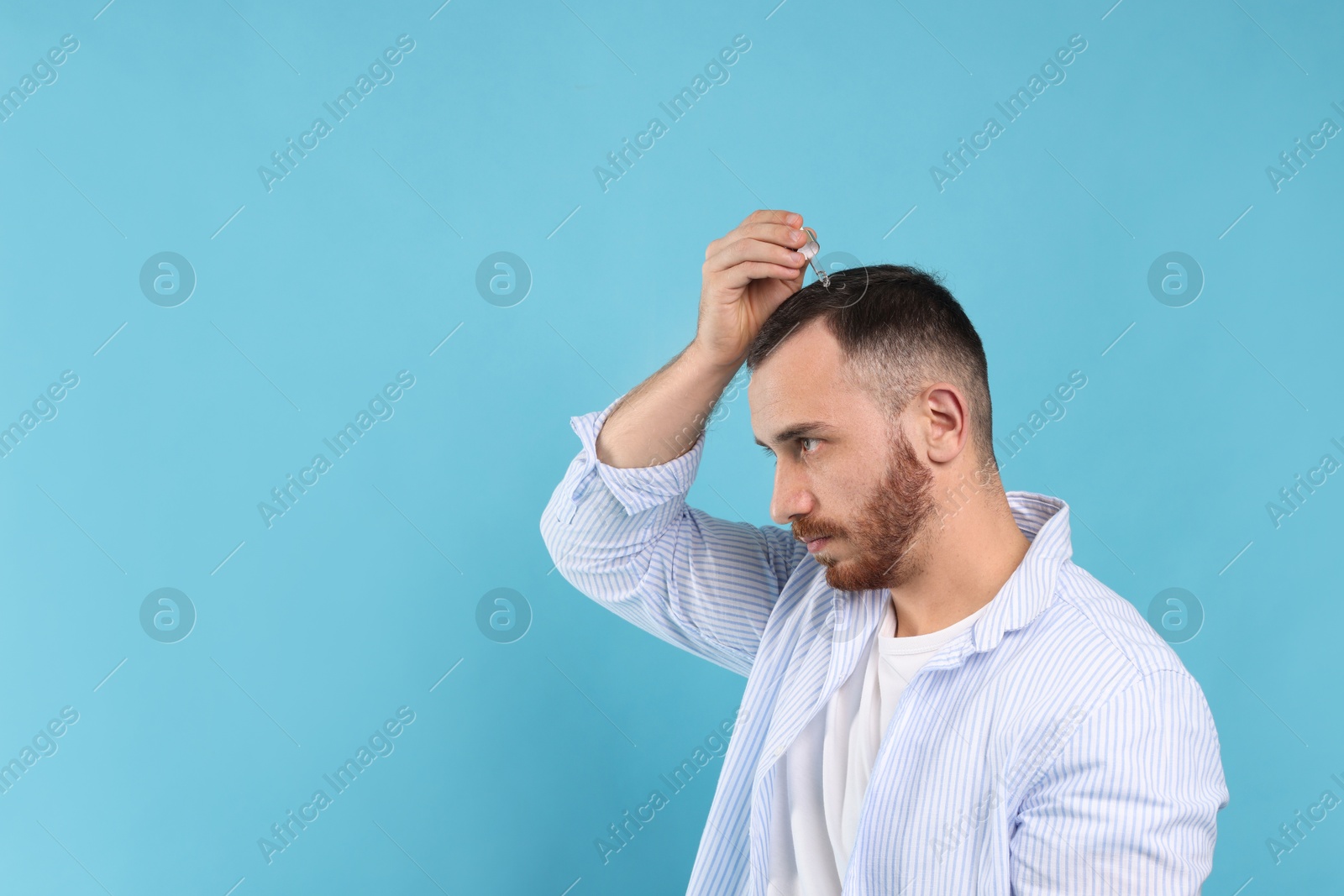 Photo of Baldness treatment. Man applying serum onto hair on light blue background. Space for text